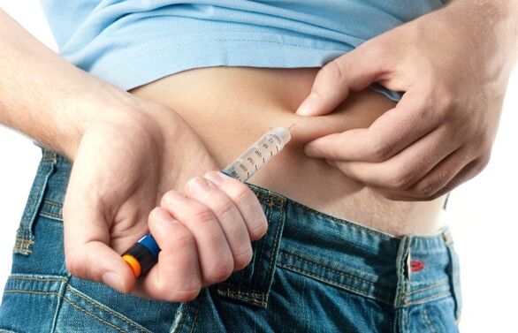Тешки дијабетес типа 2 захтева давање инсулина